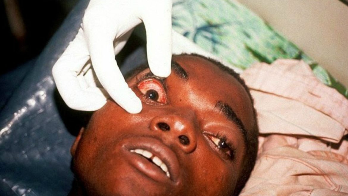 Rwanda traces Marburg virus closely as deaths hit 8