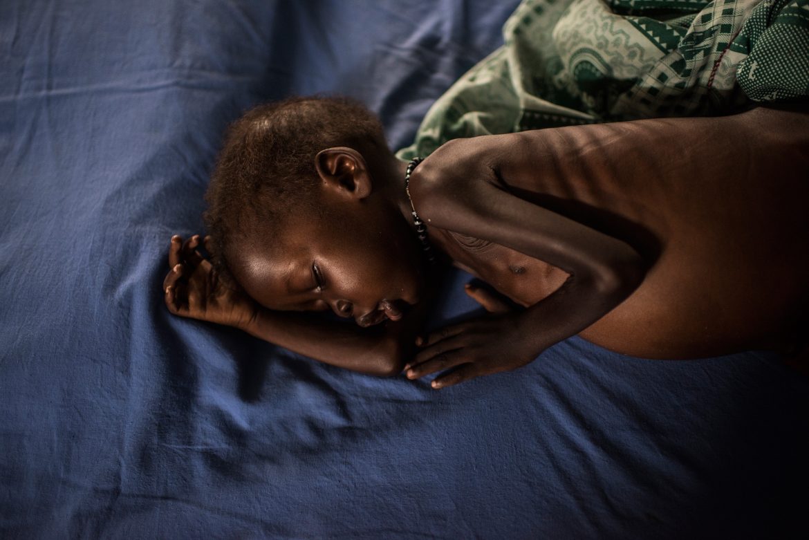 Charity warns of famine-like conditions in conflict-hit eastern South Sudan state